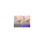 Medicube Placenta Capsule Serum 25ml product image